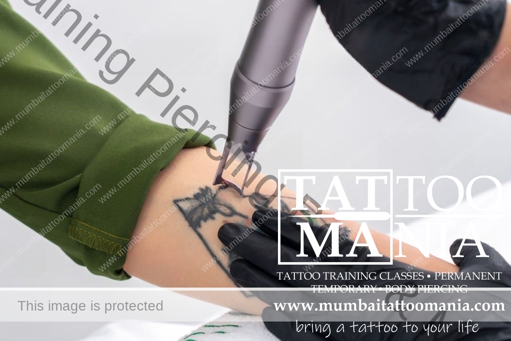 tattoo-mania-tattoo-removal